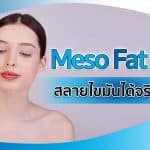 เมโสแฟต (Meso Fat) คืออะไร ช่วยลดไขมันได้จริงไหม ?