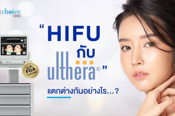 HIFU กับ Ultera แตกต่างกันอย่างไร